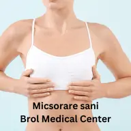 Cand sa apelezi la operatia de micsorare a sanilor?