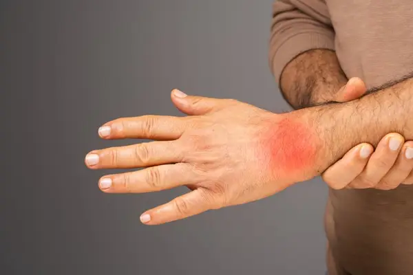 Ghid complet pentru controlul inflamației în organism