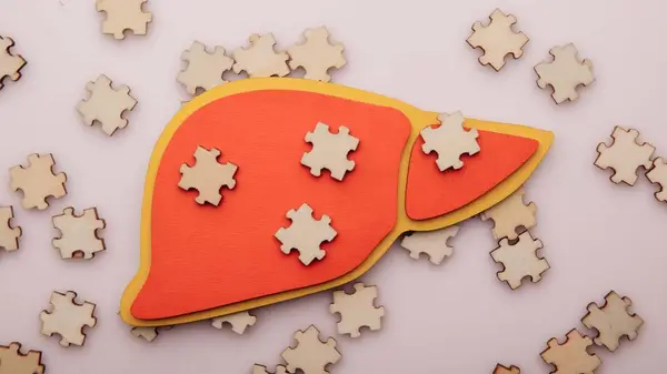 Semne că ficatul are nevoie de sprijin suplimentar